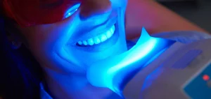 Diş Beyazlatma (Bleaching)