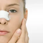 Post-Nose Aesthetic Protection