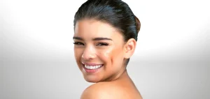 Estética de Hoyuelos