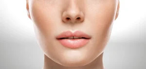 Levantamiento de Labios