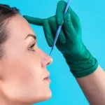 Ameliyatsız Burun Estetiği Kalıcı mıdır?