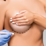 Augmentation Mammaire non Chirurgicale