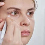 Badem Göz Estetiği Yaptıranlar