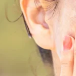 Cilt Lekeleri Nasıl Geçer?