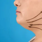 Gıdı Eritme Yöntemleri