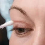 Göz Kapağı Ameliyatı Olanların Yorumları