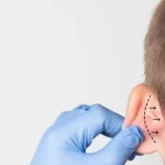 Kepçe Kulak Ameliyatı Kaç Yaşından İtibaren Yapılabilir?