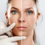 Kolajen Nedir, Ne İşe Yarar?