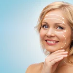 Mini Yüz Germe ve Yüz Germe Farkları