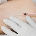 Ter Kokusuna Ne İyi Gelir?