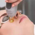 Tüy Sarartma Nedir, Nasıl Yapılır?